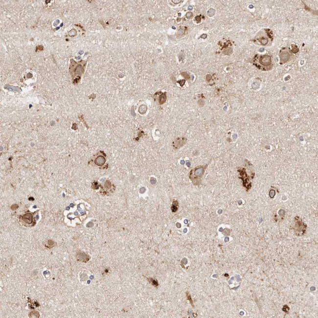 MRPS33 Antibody in Immunohistochemistry (Paraffin) (IHC (P))
