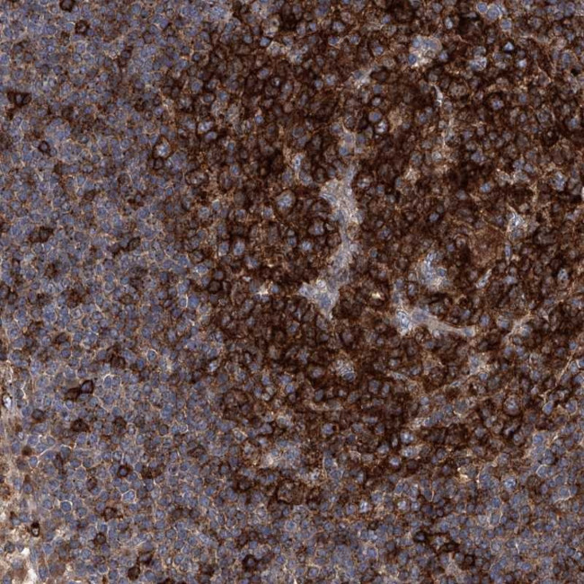 FAM167A Antibody in Immunohistochemistry (Paraffin) (IHC (P))