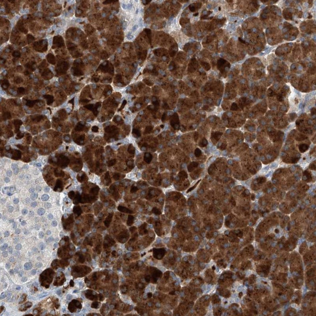KCNK10 Antibody in Immunohistochemistry (Paraffin) (IHC (P))