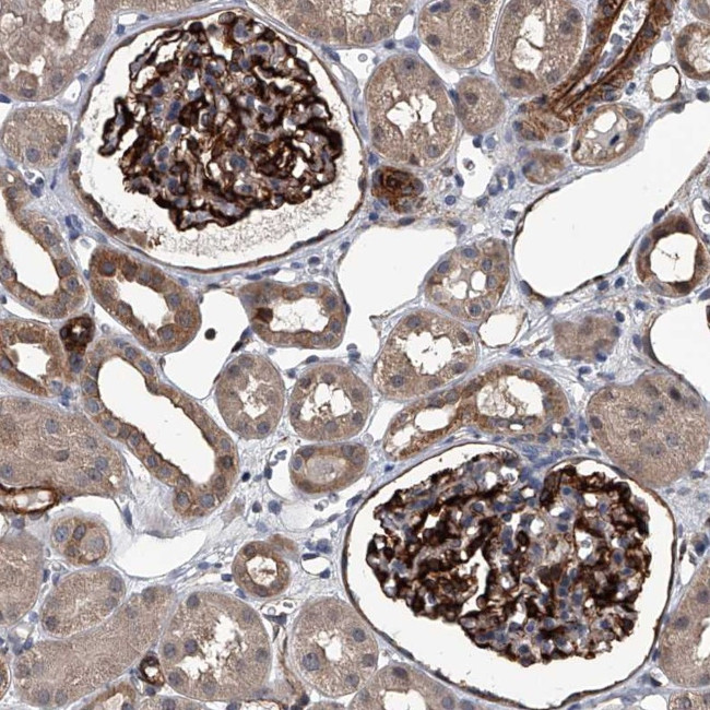 LDLRAD2 Antibody in Immunohistochemistry (Paraffin) (IHC (P))