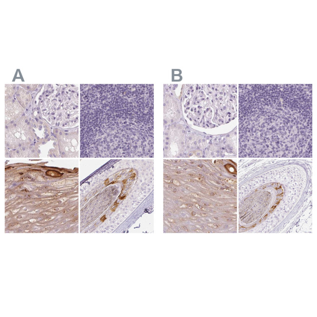 RPTN Antibody in Immunohistochemistry (IHC)