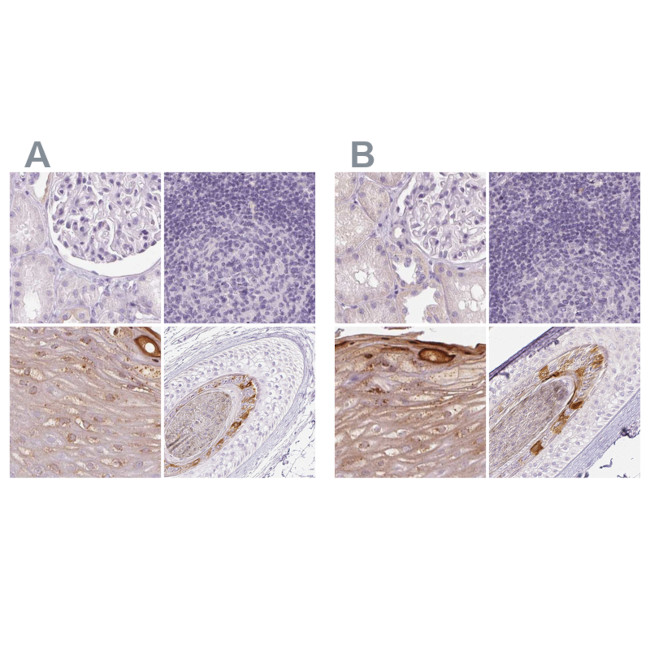 RPTN Antibody in Immunohistochemistry (IHC)
