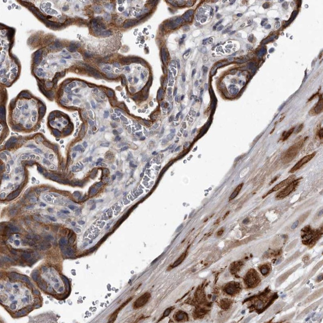 YPEL3 Antibody in Immunohistochemistry (IHC)