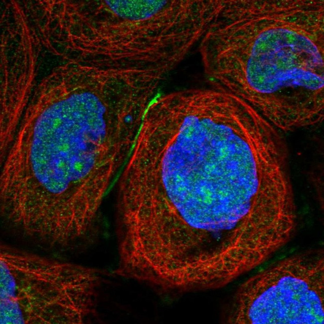 TSR2 Antibody in Immunocytochemistry (ICC/IF)