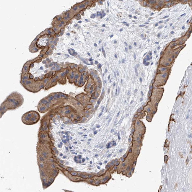 PIK3C2B Antibody in Immunohistochemistry (Paraffin) (IHC (P))