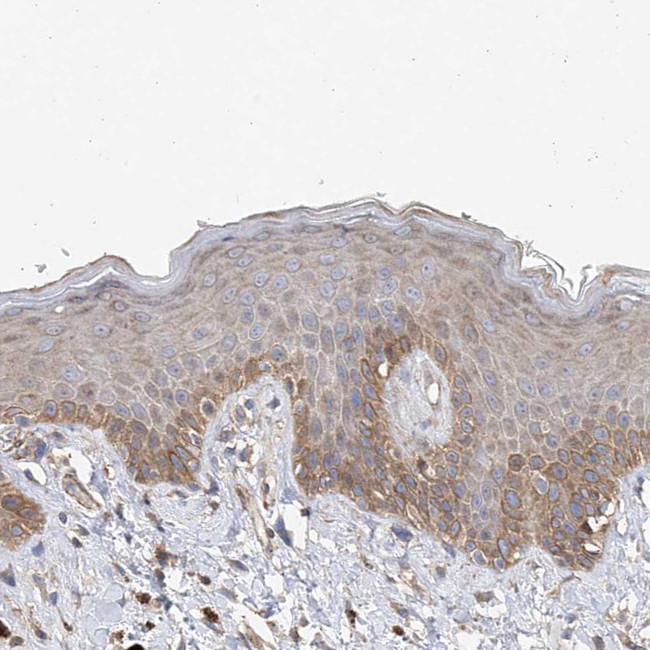SLC43A3 Antibody in Immunohistochemistry (Paraffin) (IHC (P))