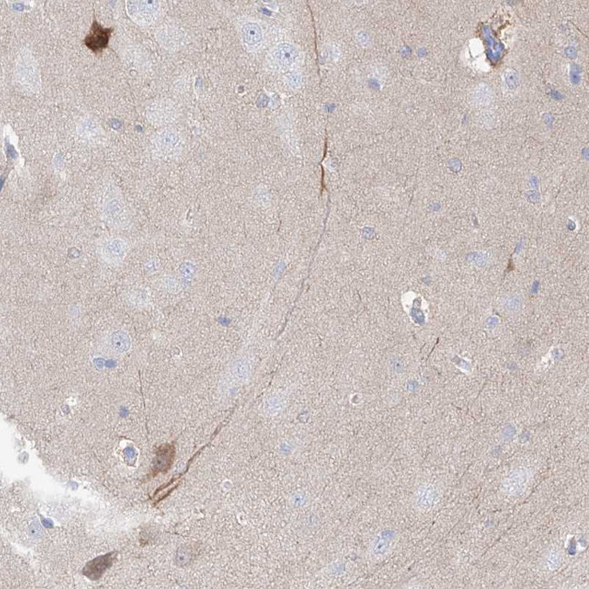 UFL1 Antibody in Immunohistochemistry (Paraffin) (IHC (P))