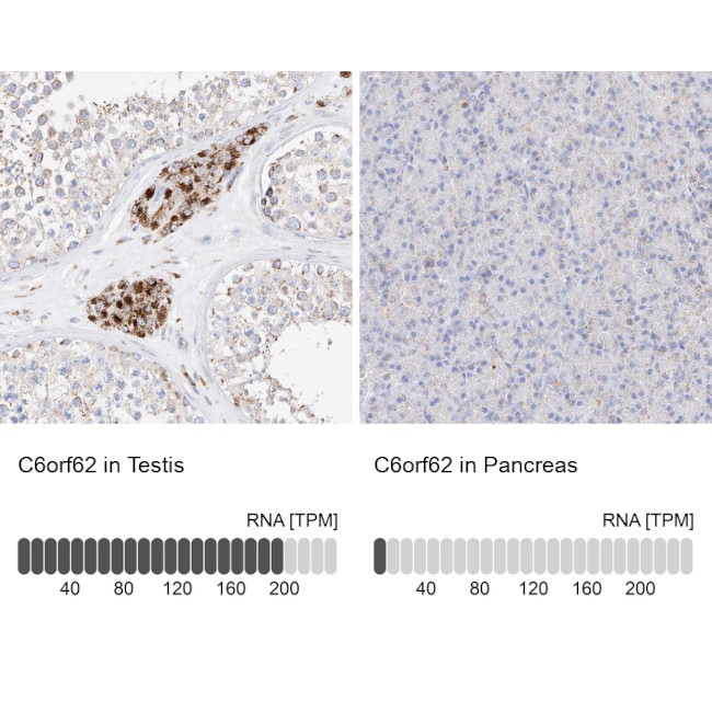 C6orf62 Antibody in Immunohistochemistry (IHC)