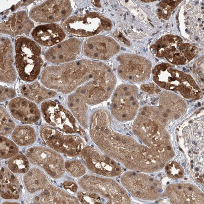 BHE23 Antibody in Immunohistochemistry (Paraffin) (IHC (P))