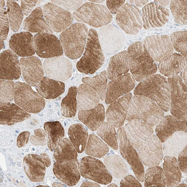 SYTL3 Antibody in Immunohistochemistry (Paraffin) (IHC (P))