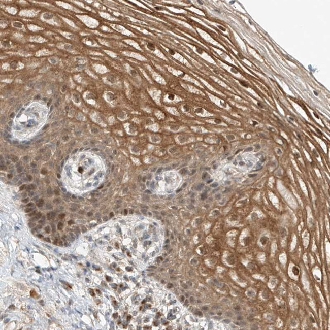 SYTL3 Antibody in Immunohistochemistry (Paraffin) (IHC (P))