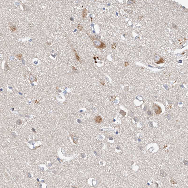 LRRC16B Antibody in Immunohistochemistry (Paraffin) (IHC (P))