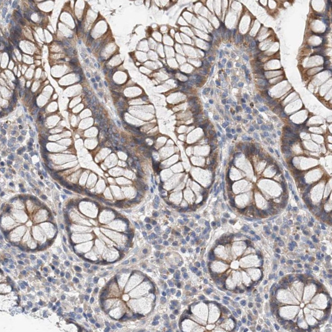 MAGEE2 Antibody in Immunohistochemistry (Paraffin) (IHC (P))
