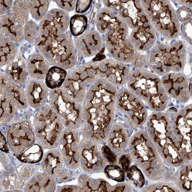 Sbk2 Antibody in Immunohistochemistry (Paraffin) (IHC (P))