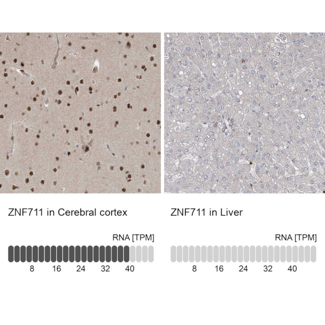 ZNF711 Antibody in Immunohistochemistry (IHC)
