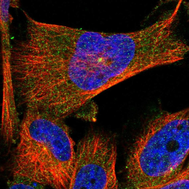 TMEM63C Antibody in Immunocytochemistry (ICC/IF)
