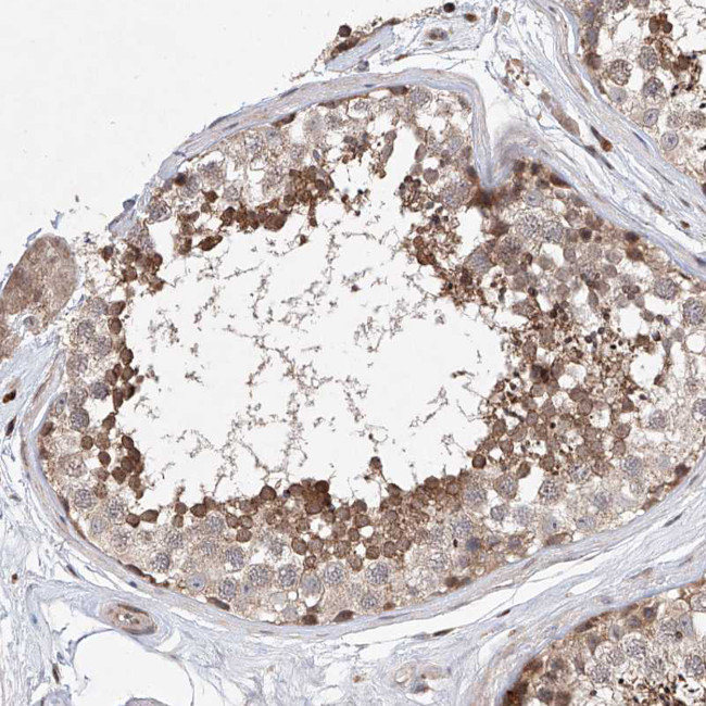 LACE1 Antibody in Immunohistochemistry (Paraffin) (IHC (P))