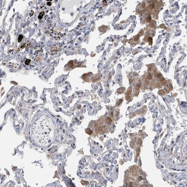 SLCO4A1 Antibody in Immunohistochemistry (Paraffin) (IHC (P))