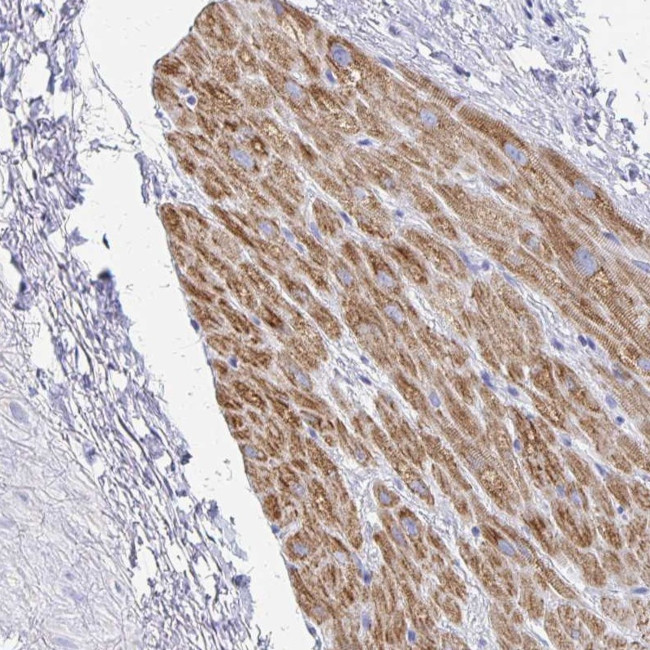 SH3BGR Antibody in Immunohistochemistry (Paraffin) (IHC (P))