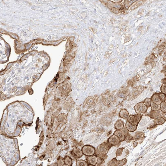 ZGRF1 Antibody in Immunohistochemistry (Paraffin) (IHC (P))