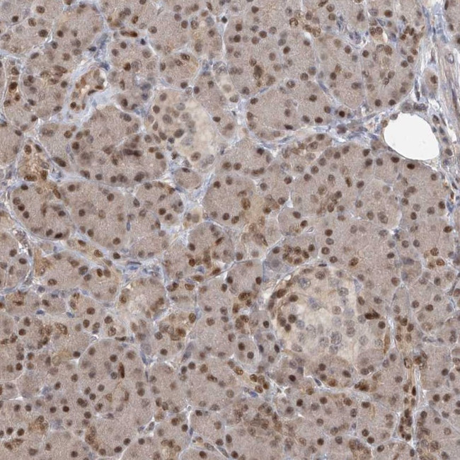 PMM1 Antibody in Immunohistochemistry (Paraffin) (IHC (P))