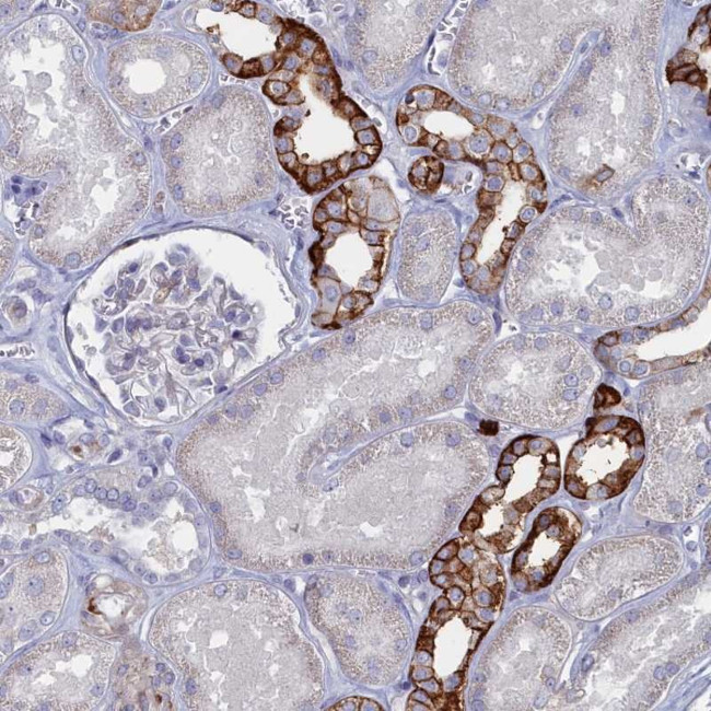 FAM159A Antibody in Immunohistochemistry (Paraffin) (IHC (P))