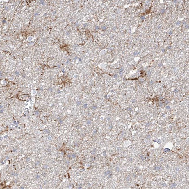 ARHGEF40 Antibody in Immunohistochemistry (Paraffin) (IHC (P))