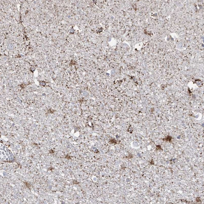 ARHGEF40 Antibody in Immunohistochemistry (Paraffin) (IHC (P))