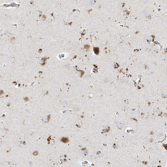 GPR137C Antibody in Immunohistochemistry (Paraffin) (IHC (P))