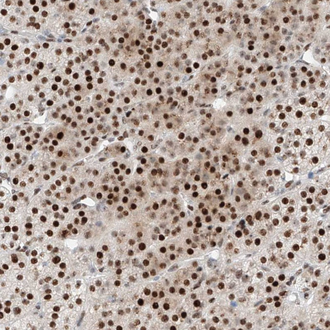 NT5C3B Antibody in Immunohistochemistry (Paraffin) (IHC (P))