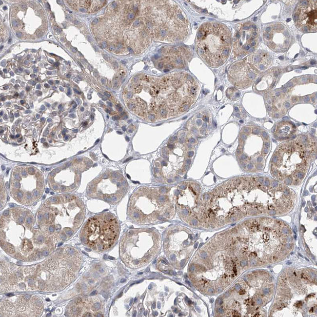 HEATR6 Antibody in Immunohistochemistry (Paraffin) (IHC (P))