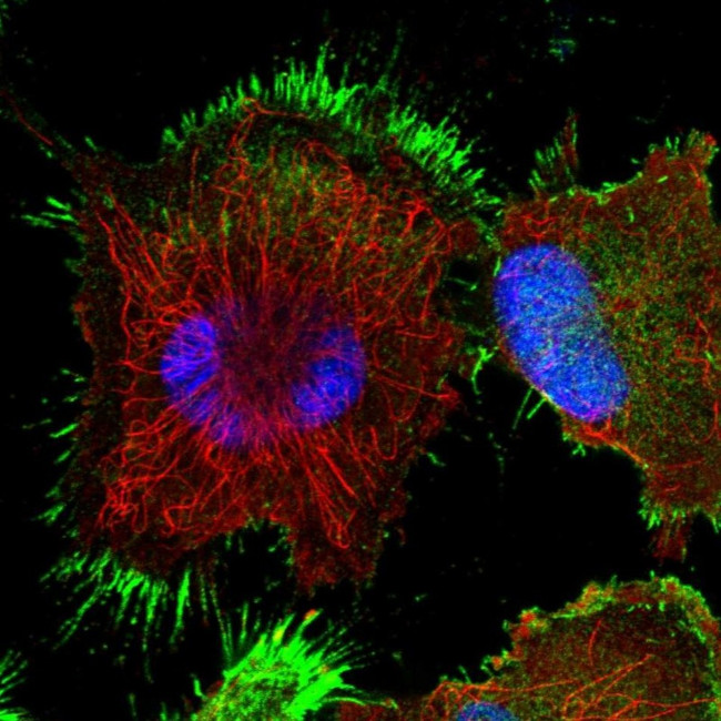 TASP1 Antibody in Immunocytochemistry (ICC/IF)