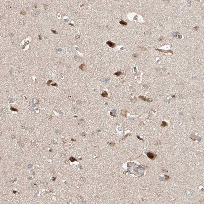 TASP1 Antibody in Immunohistochemistry (Paraffin) (IHC (P))