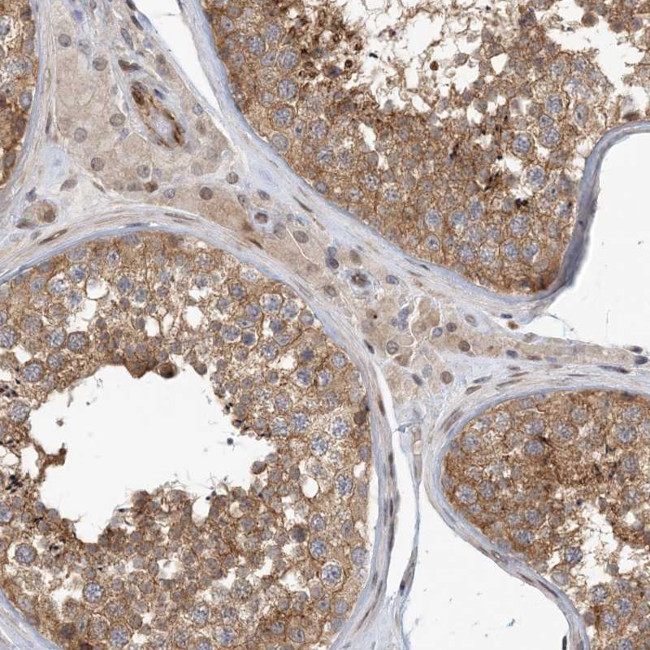 MAPKBP1 Antibody in Immunohistochemistry (Paraffin) (IHC (P))