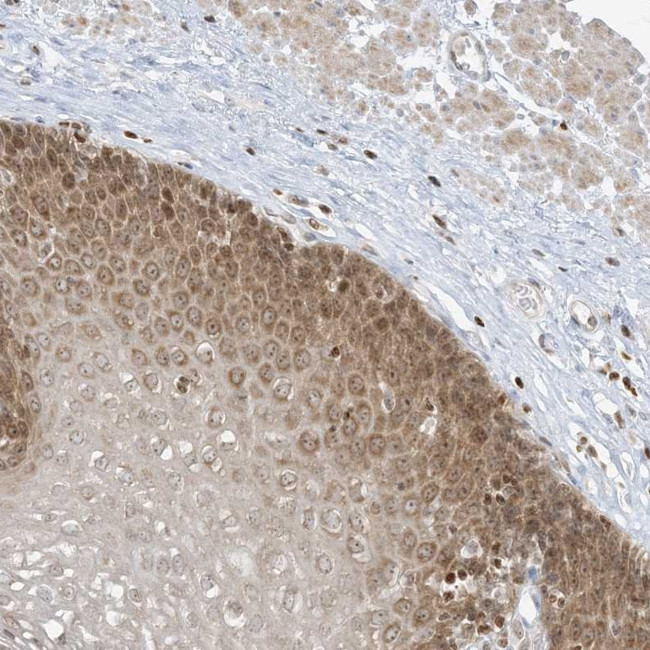 TBC1D2 Antibody in Immunohistochemistry (Paraffin) (IHC (P))