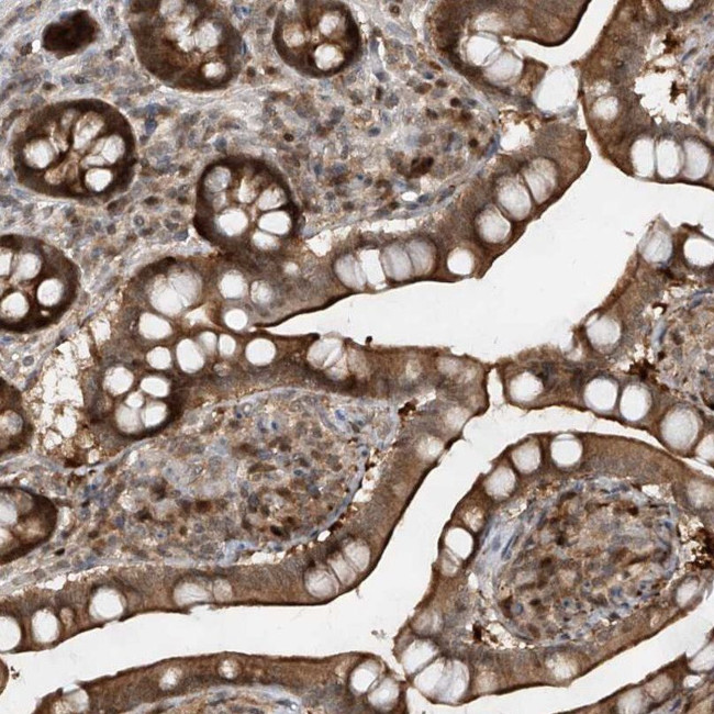 ZNF358 Antibody in Immunohistochemistry (IHC)
