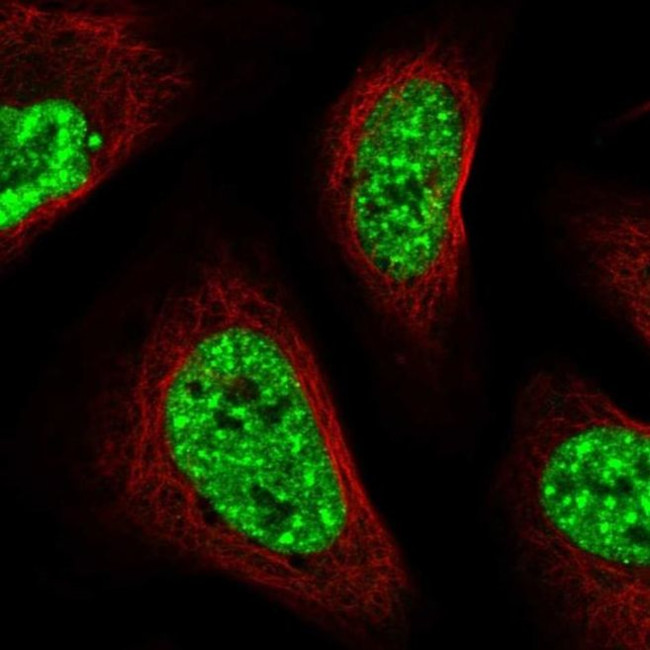 SARNP Antibody in Immunocytochemistry (ICC/IF)