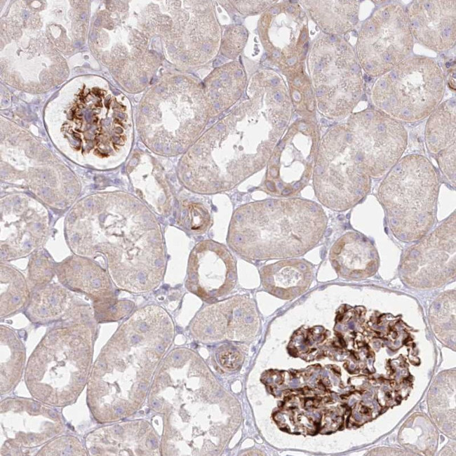 ZNF843 Antibody in Immunohistochemistry (Paraffin) (IHC (P))