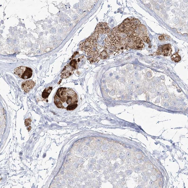 ZNF843 Antibody in Immunohistochemistry (Paraffin) (IHC (P))
