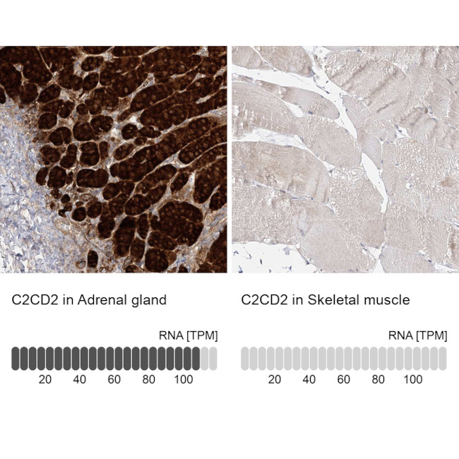 C2CD2 Antibody in Immunohistochemistry (IHC)