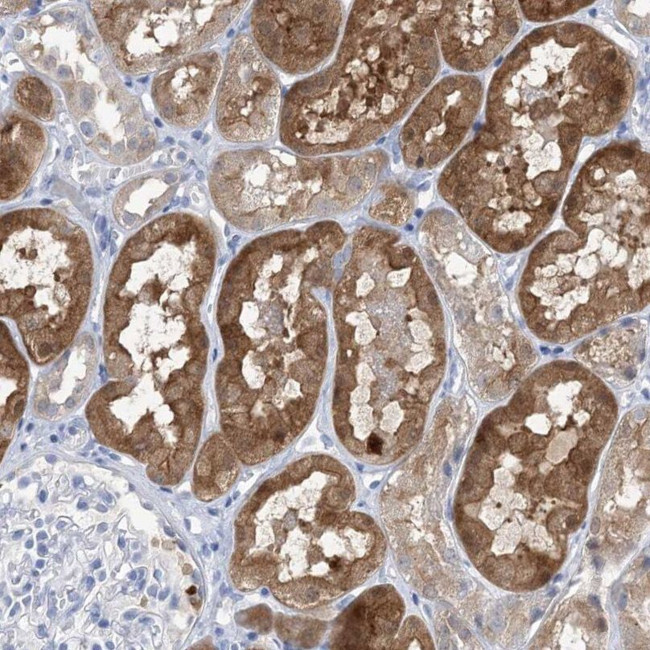 SH3YL1 Antibody in Immunohistochemistry (IHC)