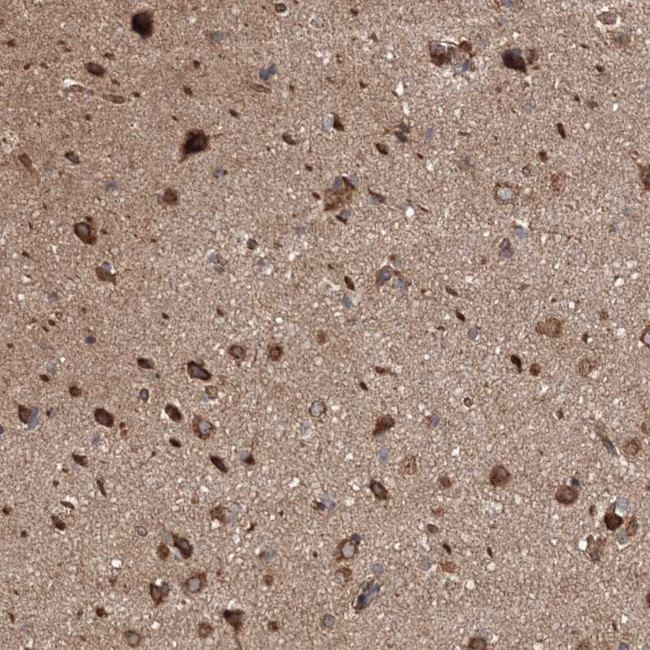 BRWD1 Antibody in Immunohistochemistry (Paraffin) (IHC (P))