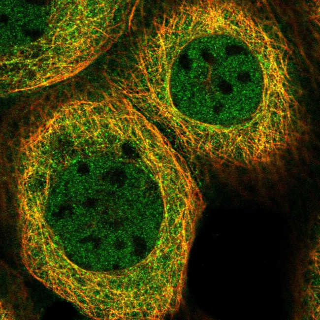 AIM1 Antibody in Immunocytochemistry (ICC/IF)