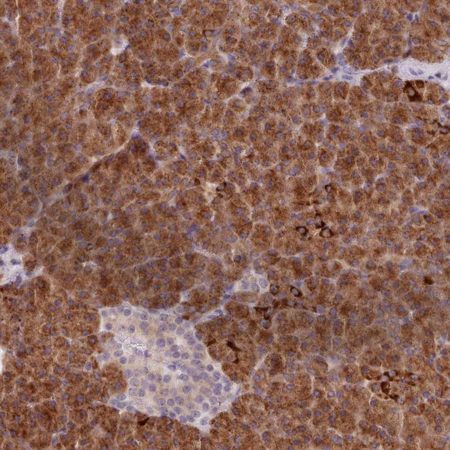 AIM1 Antibody in Immunohistochemistry (Paraffin) (IHC (P))