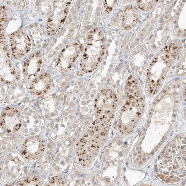 N4BP3 Antibody in Immunohistochemistry (Paraffin) (IHC (P))