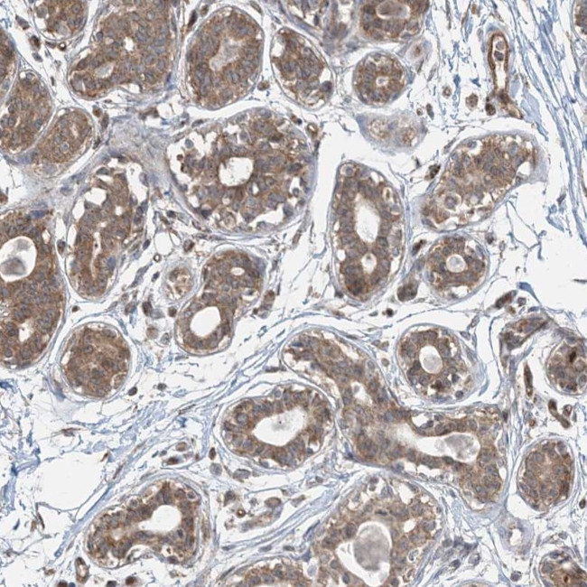 PPM1F Antibody in Immunohistochemistry (Paraffin) (IHC (P))