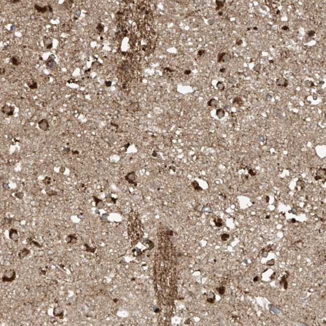 TAGAP Antibody in Immunohistochemistry (Paraffin) (IHC (P))