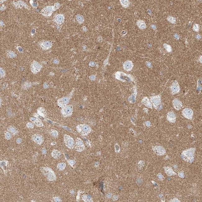 Prosapip1 Antibody in Immunohistochemistry (IHC)
