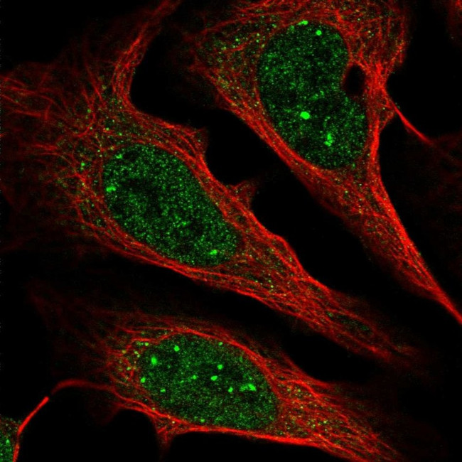 ZCCHC12 Antibody in Immunocytochemistry (ICC/IF)