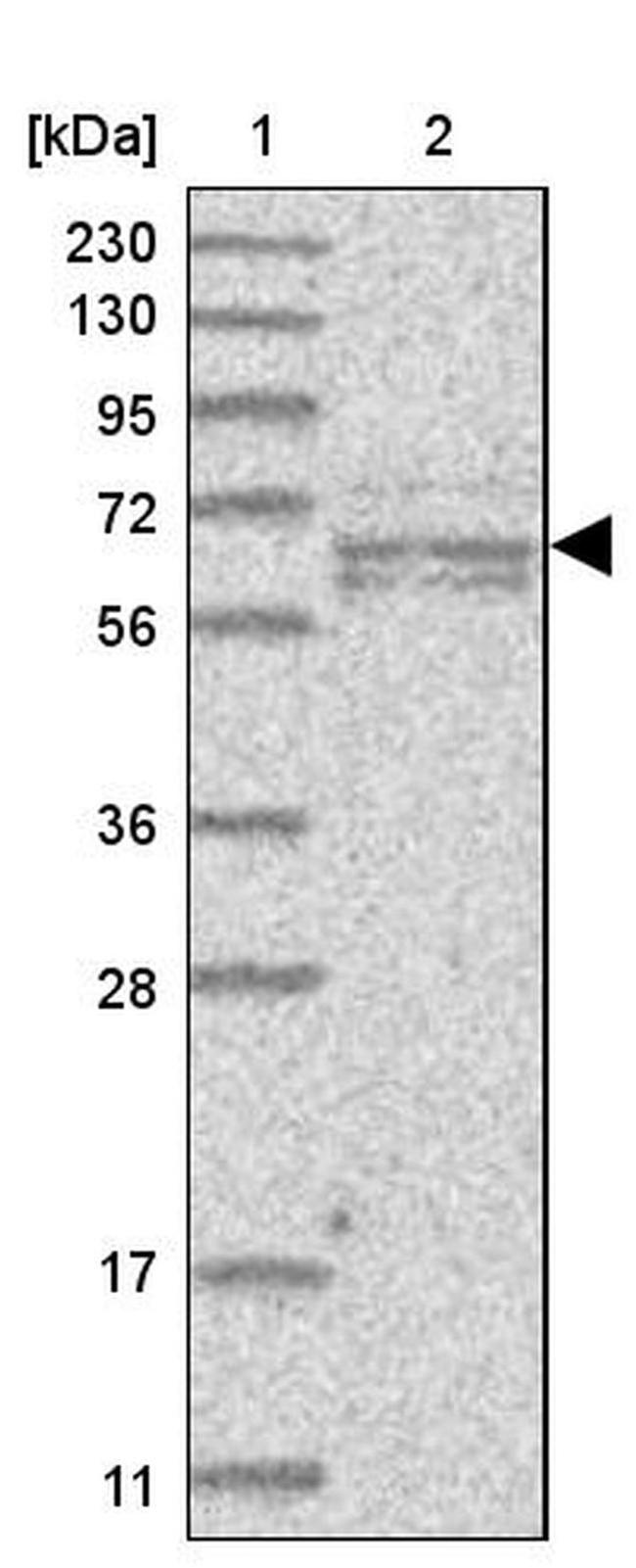 GALNTL6 Antibody in Western Blot (WB)